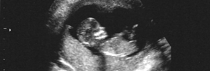 la ultrasunete cum arată penisul